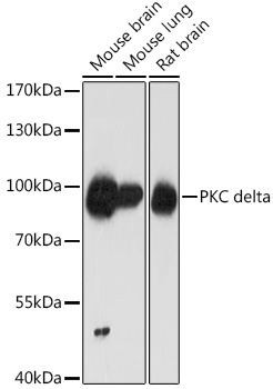 PKC delta Rabbit Polyclonal Antibody