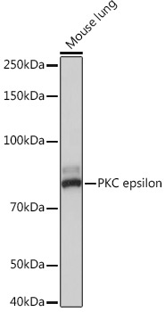 PKC epsilon Rabbit Monoclonal Antibody