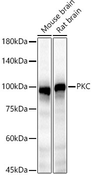 PKC epsilon Rabbit Polyclonal Antibody