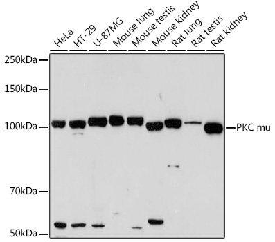 PKC mu Rabbit Monoclonal Antibody