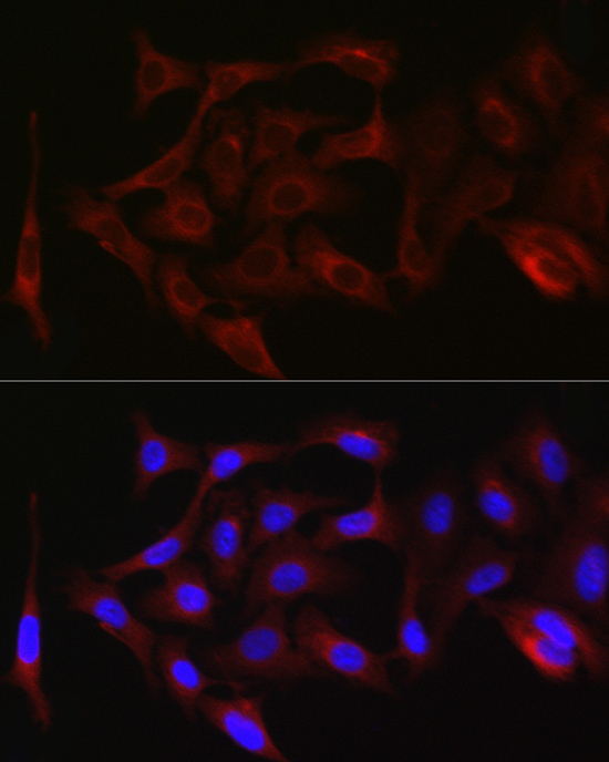PKC zeta Rabbit Polyclonal Antibody - Image 2