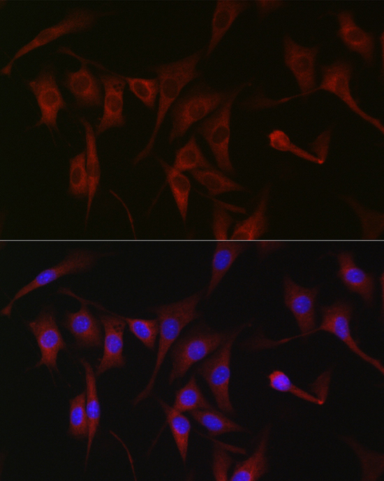 PKC zeta Rabbit Polyclonal Antibody - Image 3