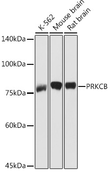 PKC-beta Rabbit Polyclonal Antibody