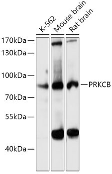 PKC-beta Rabbit Polyclonal Antibody