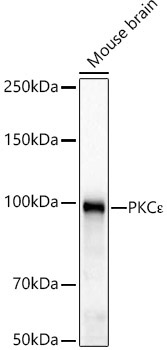 PKC? Rabbit Monoclonal Antibody