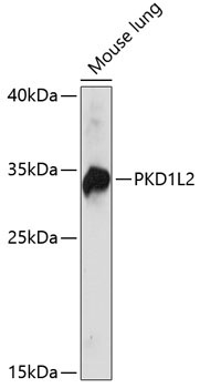 PKD1L2 Rabbit Polyclonal Antibody