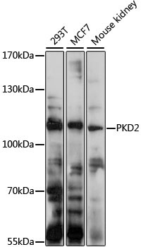 PKD2 Rabbit Polyclonal Antibody