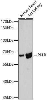 PKLR Rabbit Polyclonal Antibody