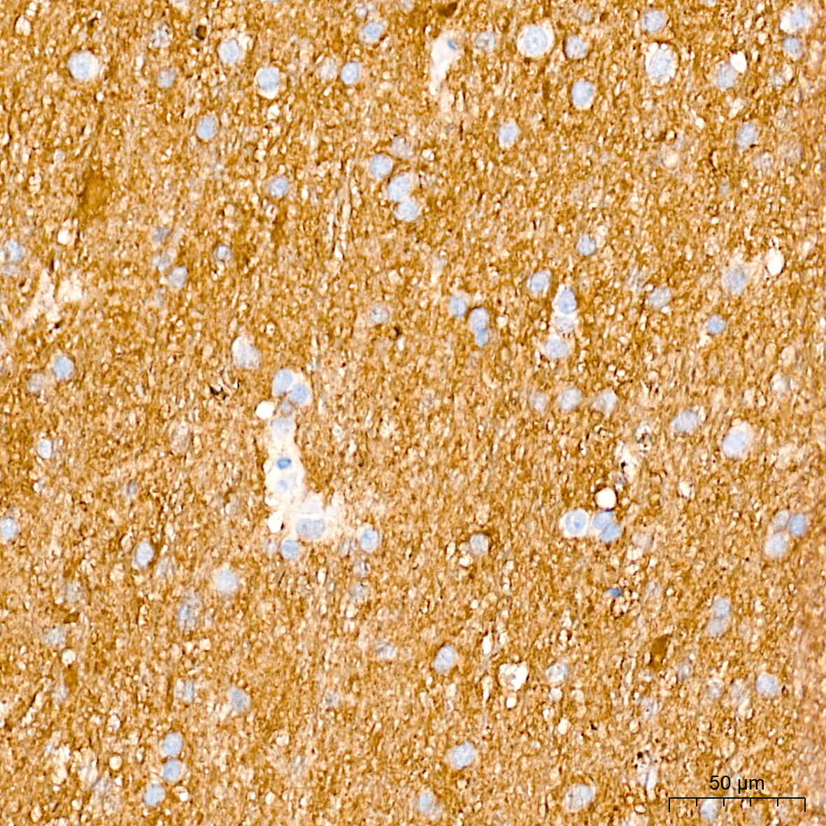 PKM1-specific Rabbit Monoclonal Antibody - Image 2