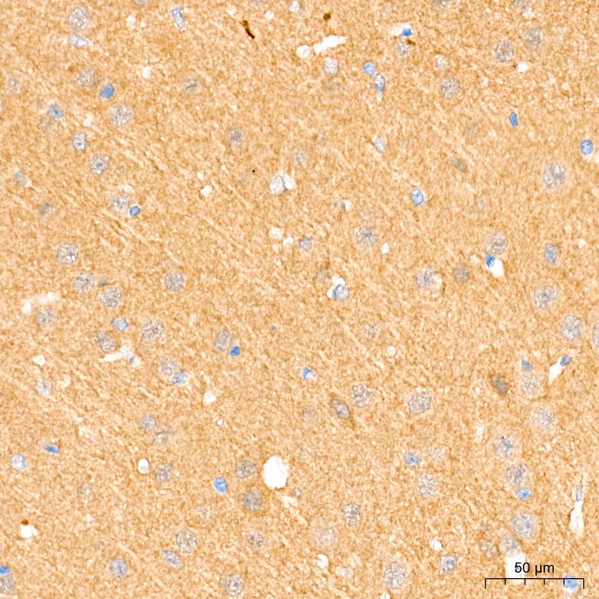 PKM1-specific Rabbit Monoclonal Antibody - Image 5