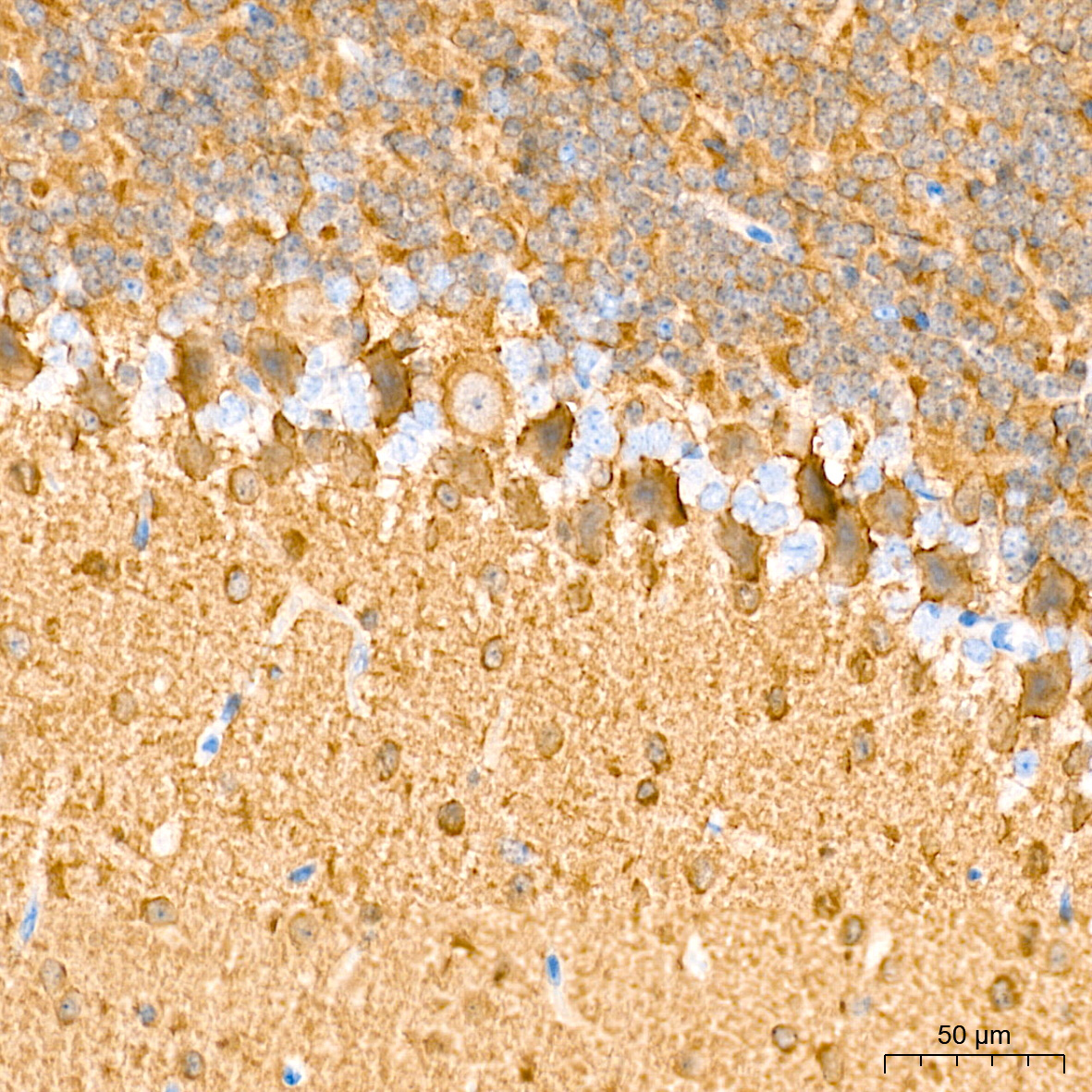 PKM1-specific Rabbit Monoclonal Antibody - Image 6
