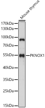 PKNOX1 Rabbit Polyclonal Antibody - Image 2