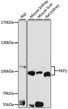 PKP2 Rabbit Polyclonal Antibody