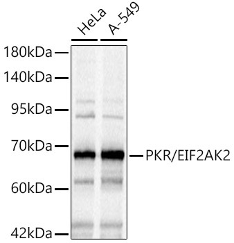 PKR/EIF2AK2 Rabbit Polyclonal Antibody