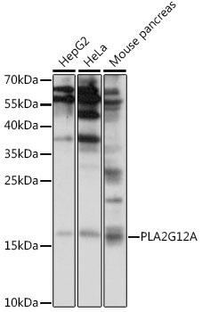 PLA2G12A Rabbit Polyclonal Antibody