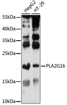 PLA2G16 Rabbit Polyclonal Antibody