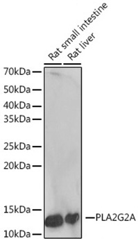 PLA2G2A Rabbit Monoclonal Antibody