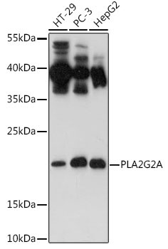 PLA2G2A Rabbit Polyclonal Antibody