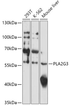 PLA2G3 Rabbit Polyclonal Antibody
