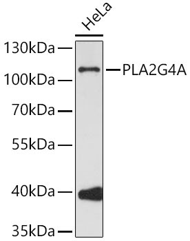 PLA2G4A Rabbit Polyclonal Antibody