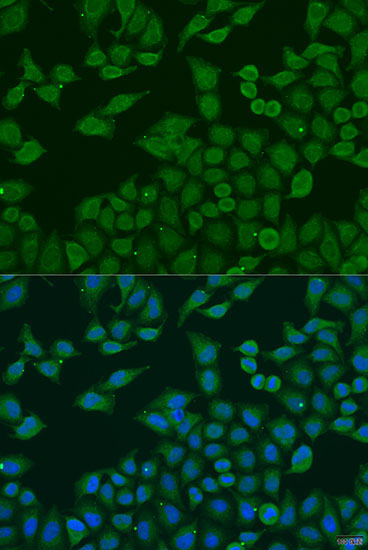 PLA2G4C Rabbit Polyclonal Antibody