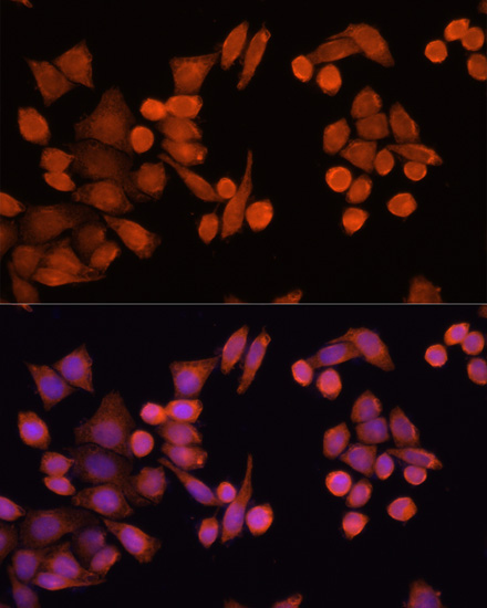 PLA2G4D Rabbit Polyclonal Antibody