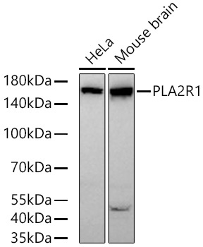 PLA2R1 Rabbit Monoclonal Antibody
