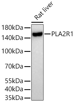 PLA2R1 Rabbit Monoclonal Antibody - Image 2