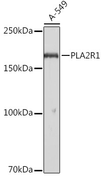 PLA2R1 Rabbit Polyclonal Antibody