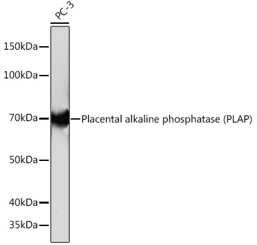 Placental alkaline phosphatase (PLAP) Rabbit Monoclonal Antibody