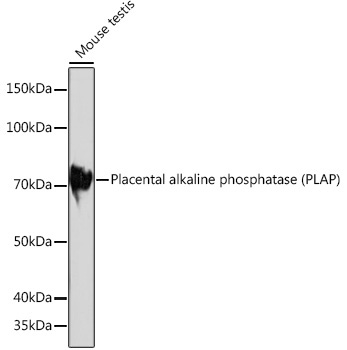 Placental alkaline phosphatase (PLAP) Rabbit Monoclonal Antibody - Image 2