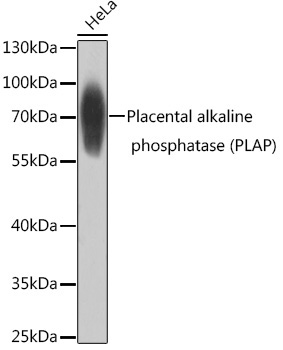 Placental alkaline phosphatase (PLAP) Rabbit Polyclonal Antibody