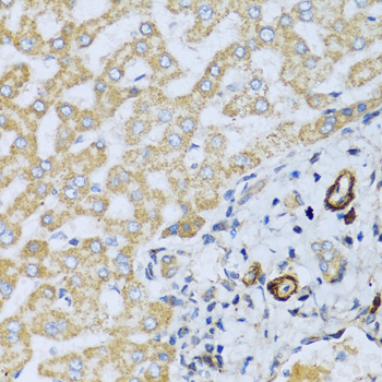 Placental lactogen (CSH1) Rabbit Polyclonal Antibody