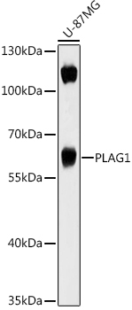 PLAG1 Rabbit Polyclonal Antibody