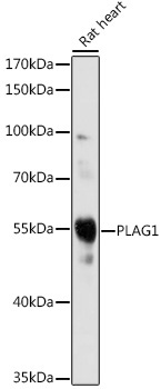 PLAG1 Rabbit Polyclonal Antibody