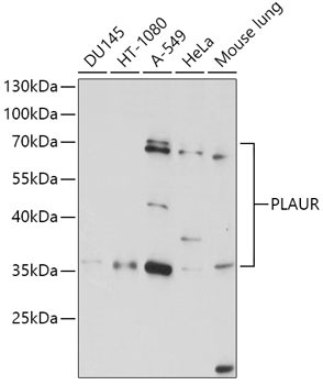 PLAUR Rabbit Polyclonal Antibody