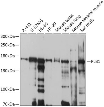 PLB1 Rabbit Polyclonal Antibody
