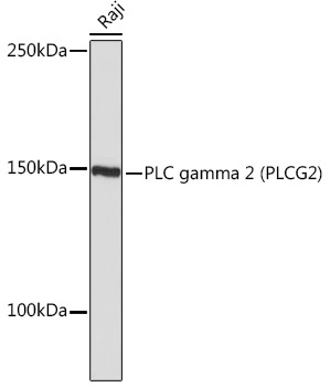 PLC gamma 2 (PLCG2) Rabbit Monoclonal Antibody