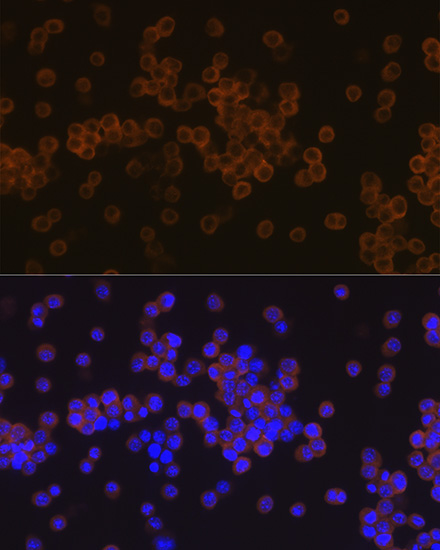 PLC gamma 2 (PLCG2) Rabbit Monoclonal Antibody - Image 2