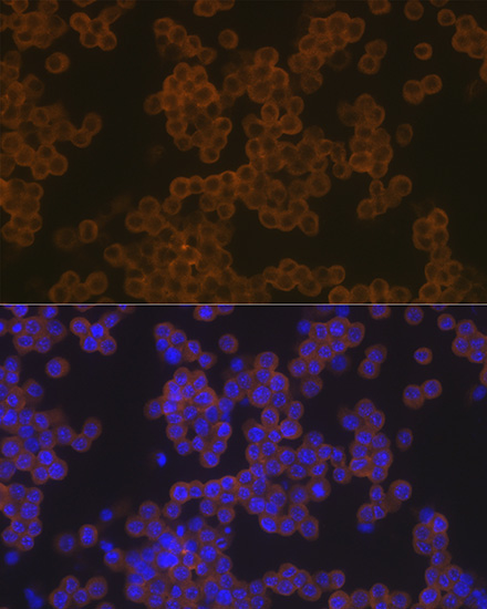 PLC gamma 2 (PLCG2) Rabbit Monoclonal Antibody - Image 3