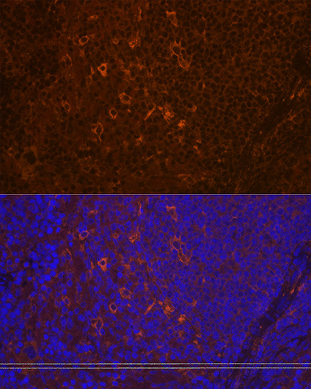 PLC gamma 2 (PLCG2) Rabbit Monoclonal Antibody - Image 4