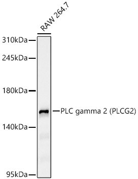 PLC gamma 2 (PLCG2)?Rabbit Monoclonal Antibody