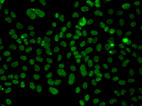 PLCXD2 Rabbit Polyclonal Antibody