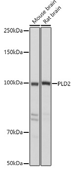 PLD2 Rabbit Polyclonal Antibody