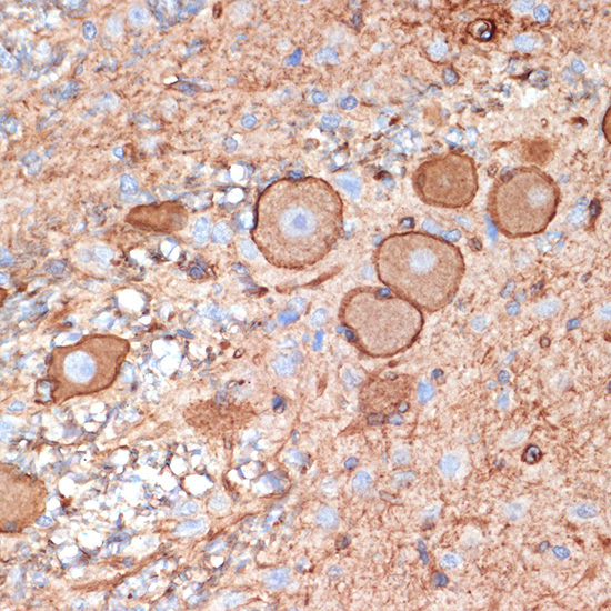 Plectin Rabbit Monoclonal Antibody