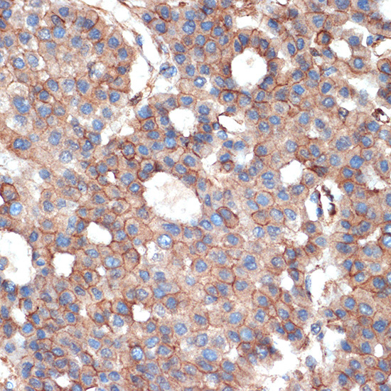 Plectin Rabbit Monoclonal Antibody - Image 2