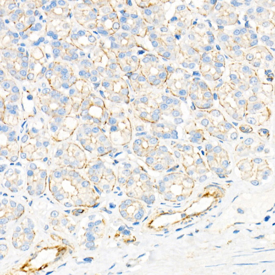 Plectin Rabbit Monoclonal Antibody