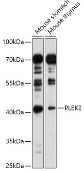 PLEK2 Rabbit Polyclonal Antibody