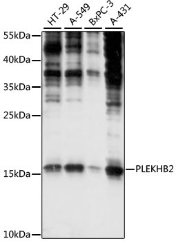 PLEKHB2 Rabbit Polyclonal Antibody