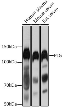 PLG Rabbit Polyclonal Antibody